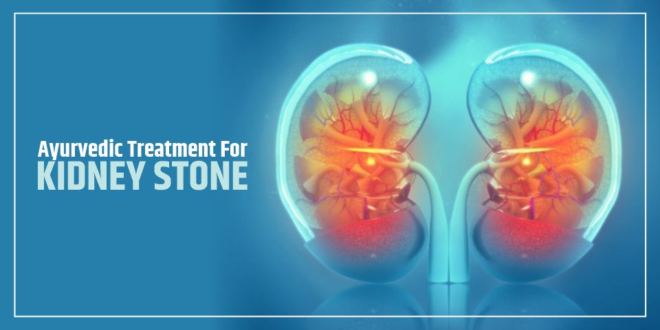 Ayurvedic Treatment For Kidney Stones