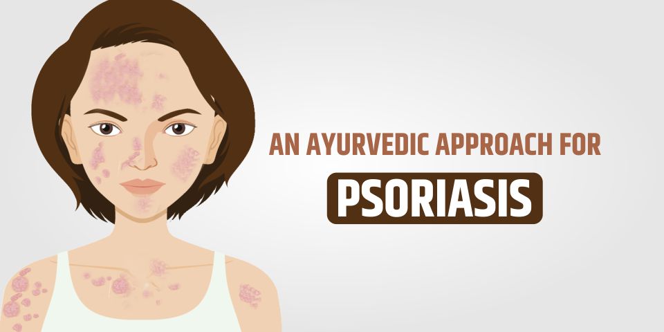 Best Ayurvedic Treatment For Psoriasis