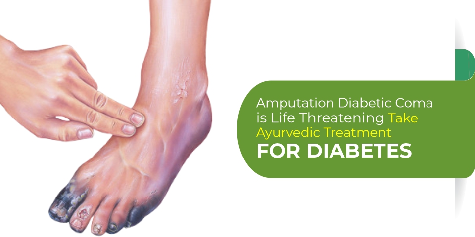 Ayurvedic treatment for diabetes