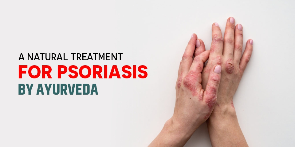 Ayurvedic treatment for Psoriasis