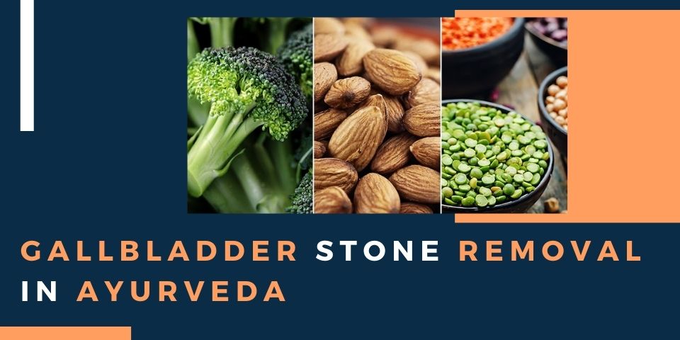 Gallbladder stone removal in Ayurveda