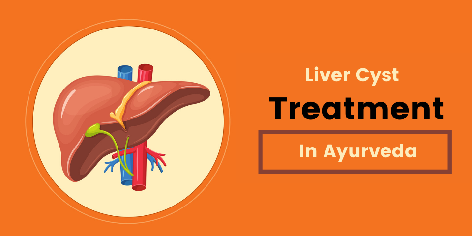 liver cyst treatment in ayurveda
