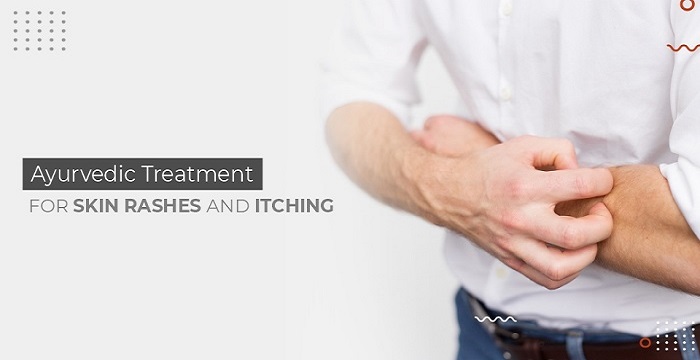 ayurvedic treatment for skin rashes and itching