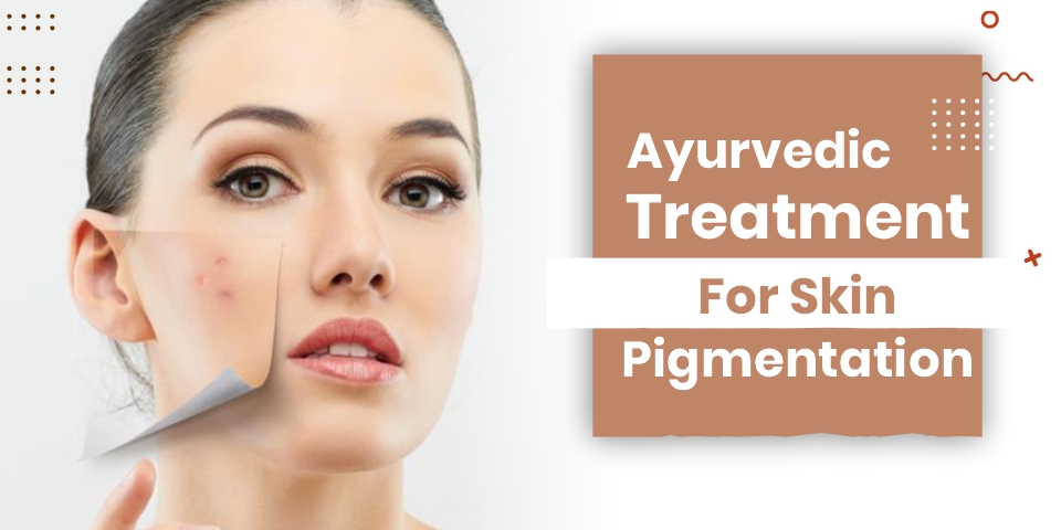 Ayurvedic Treatment for Skin PIgmentation