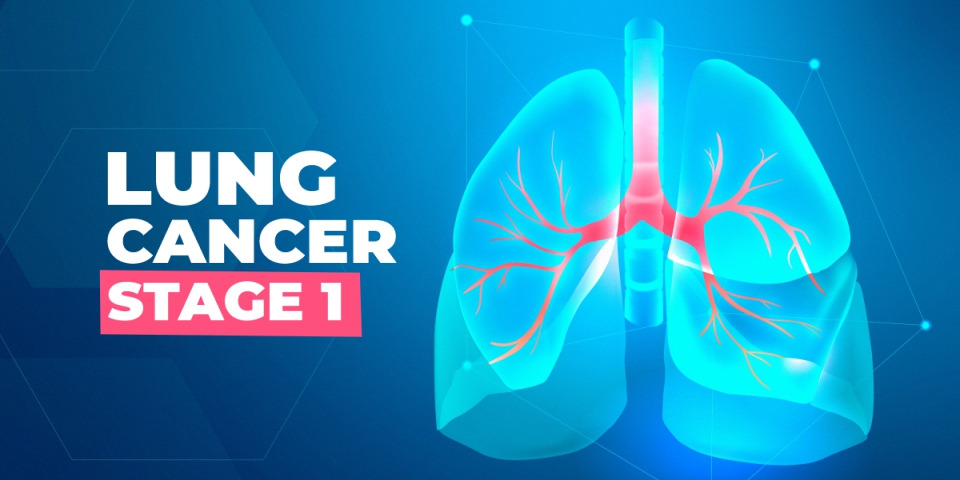 Lung Cancer Stage 1