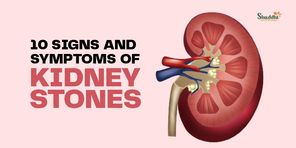 Signs And Symptoms Of Kidney Stones