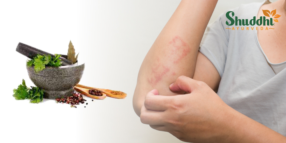 Skin-Allergy-Home-Remedies