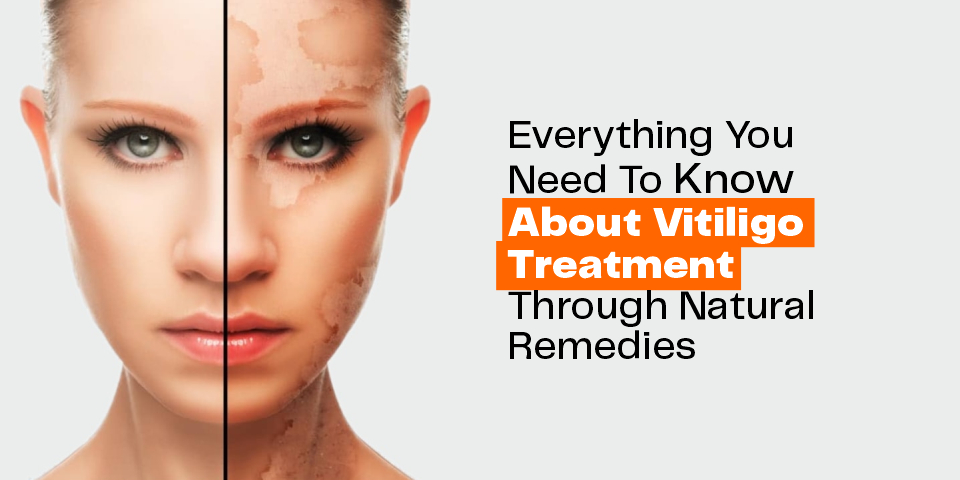 treatment for white patches