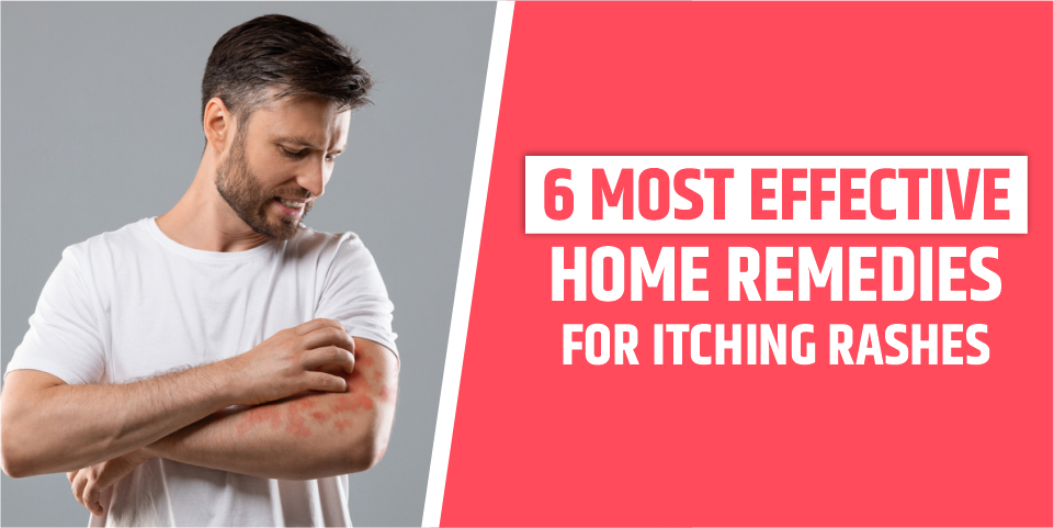 Home Remedies For Itching Rashes