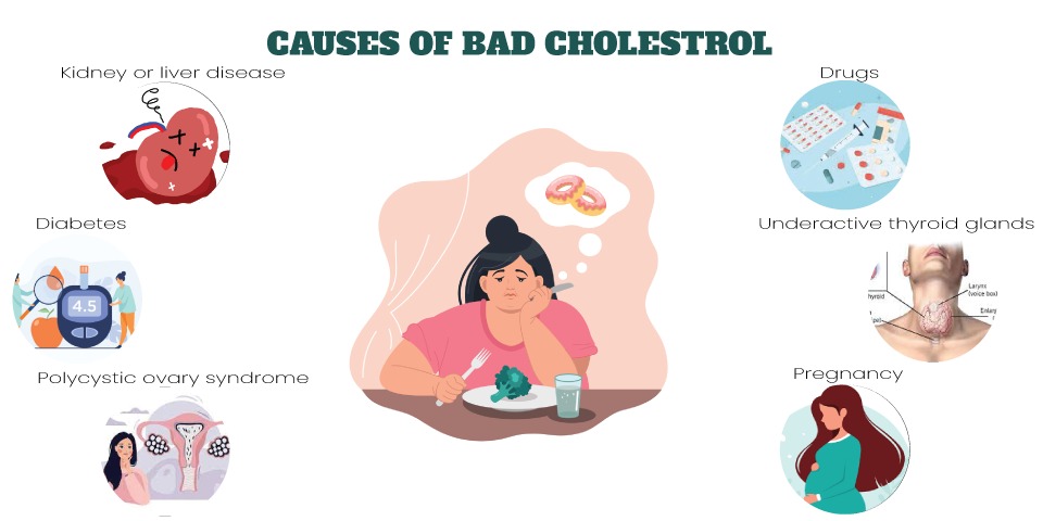 Causes of Bad Cholesterol