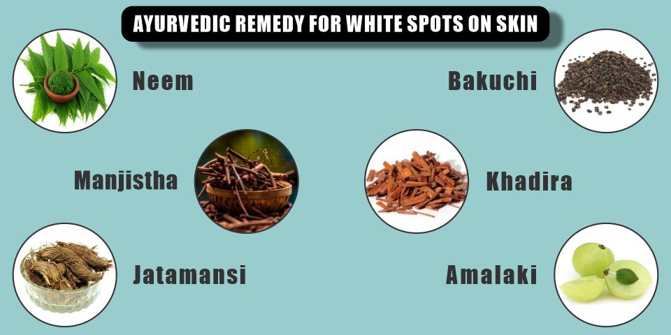 Ayurvedic Remedies for White Spots on Skin