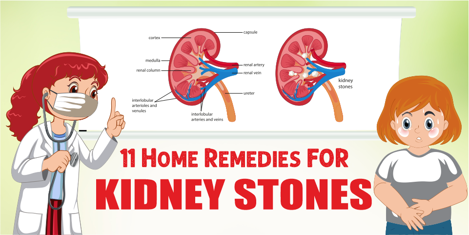Home Remedies For Kidney Stones