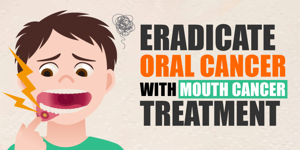 Mouth Cancer Treatment