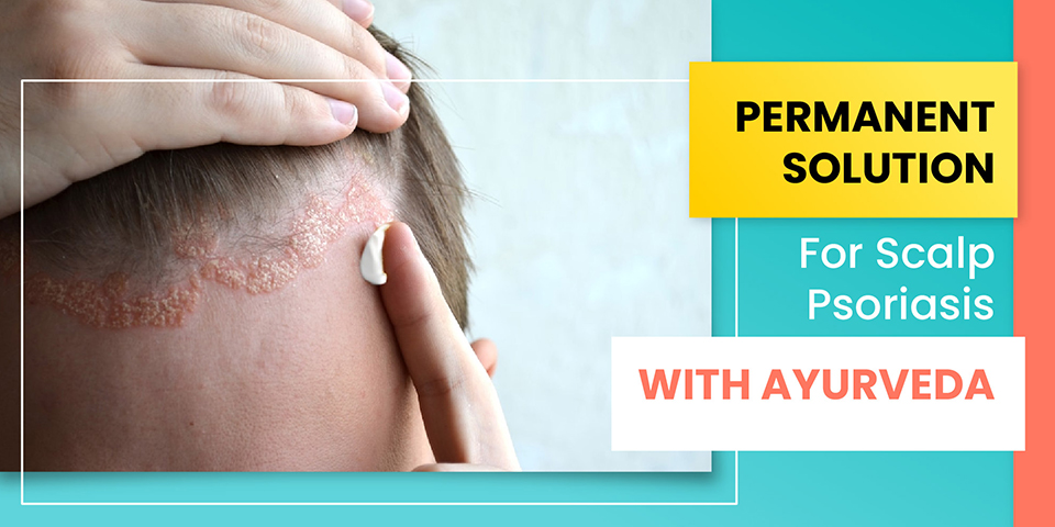 ayurvedic treatment for scalp psoriasis