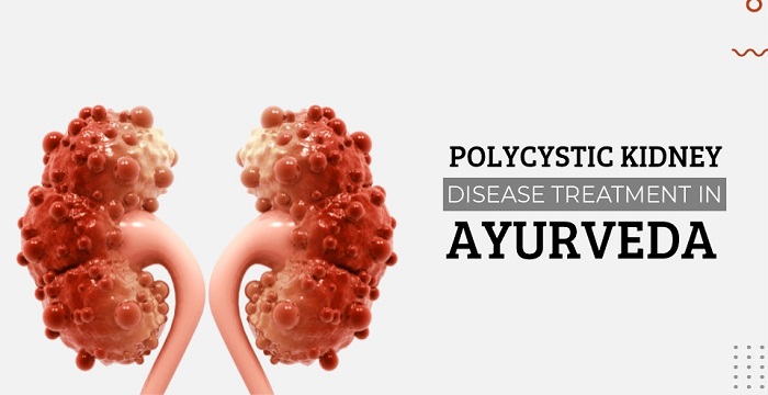 polycystic kidney disease treatment in ayurveda
