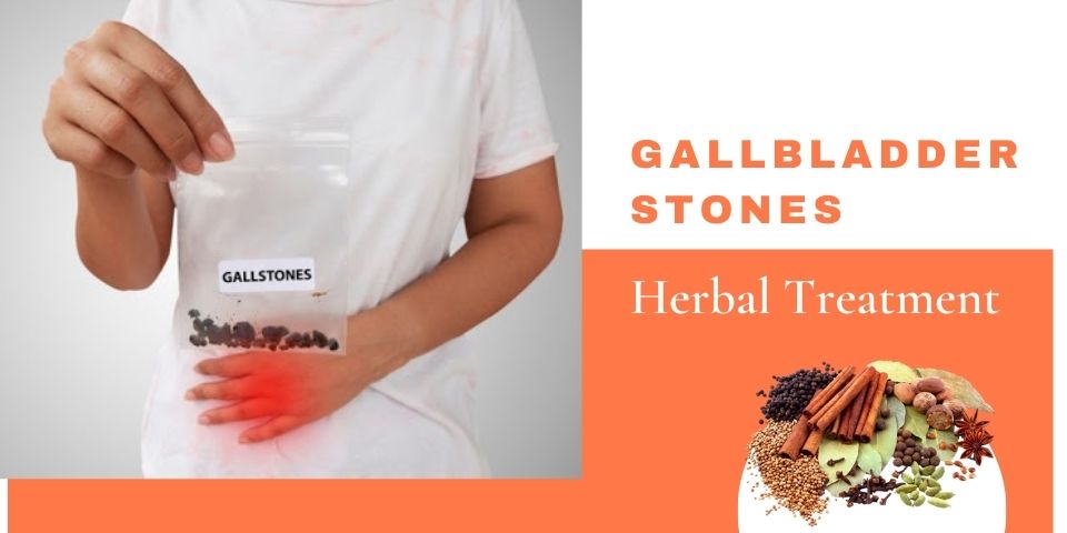 Gallbladder Stones Herbal Treatment