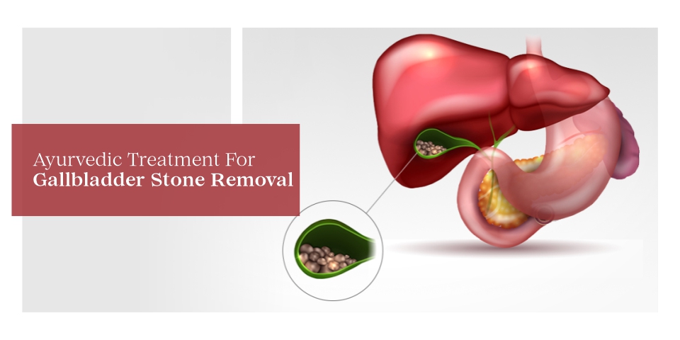 Ayurvedic Treatment For Gallbladder Stone Removal