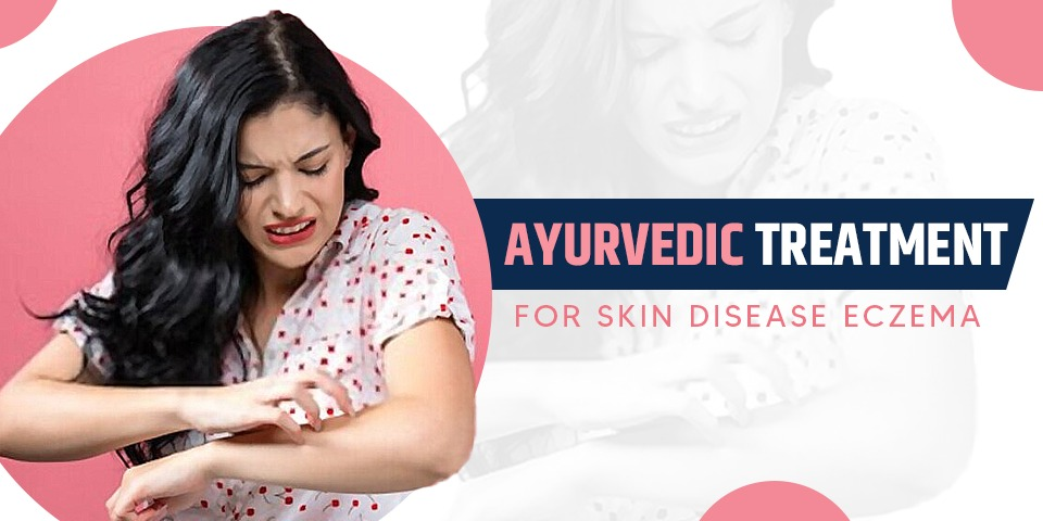 Ayurvedic Treatment for Skin Disease Eczema