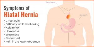 Symptoms of Hernia 
