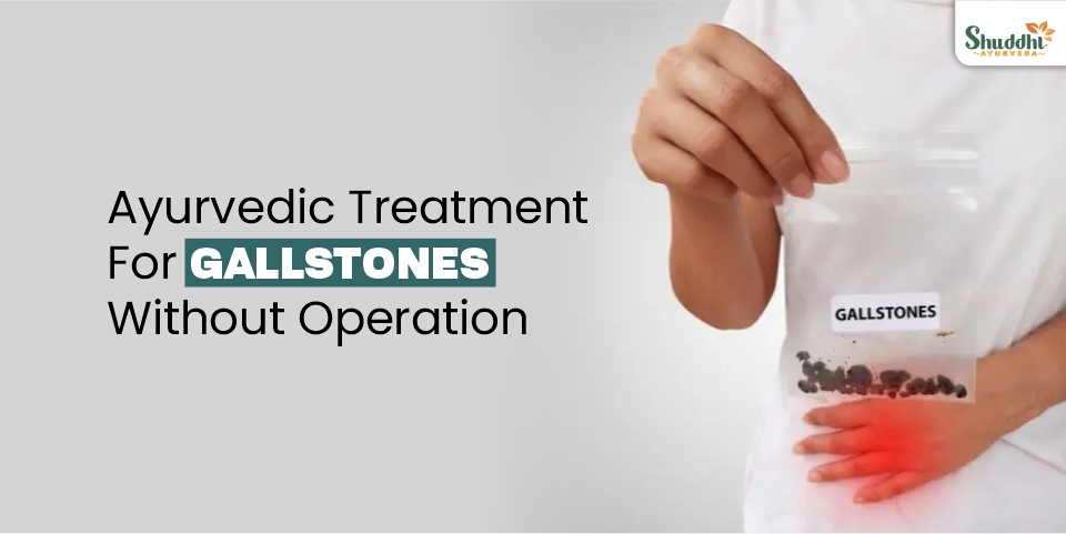 Ayurvedic-Treatment-for-Gallstones
