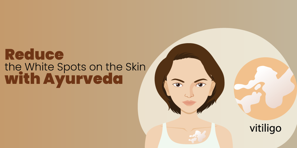 Reduce the White Spots on the Skin with Ayurveda
