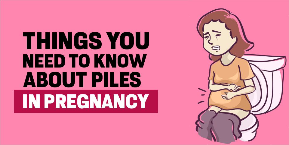 Things You Need To Know About Piles In Pregnancy