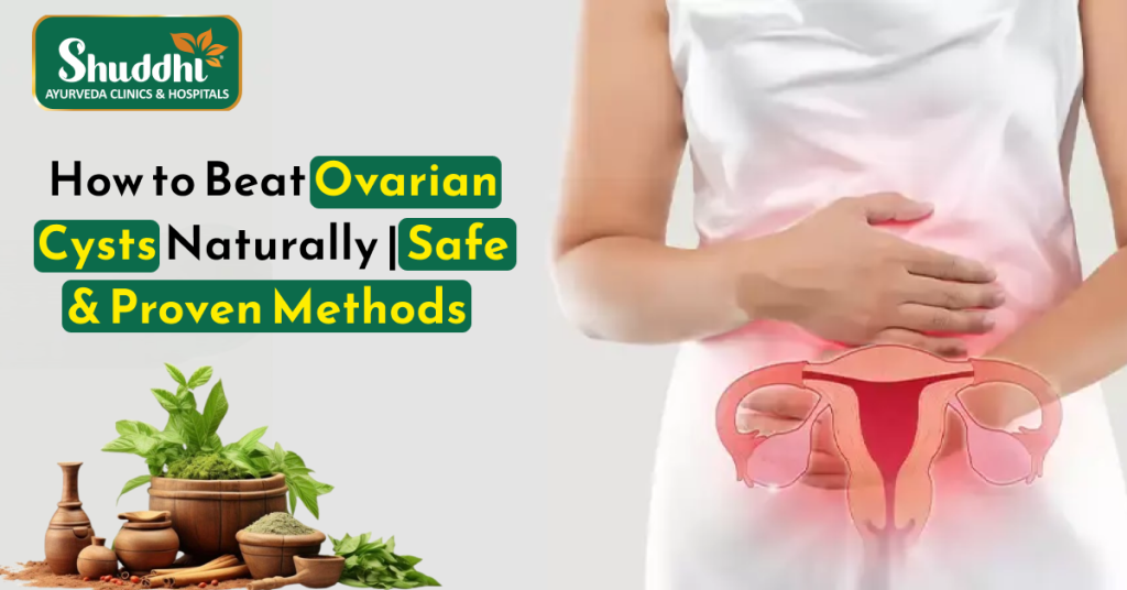 How to Beat Ovarian Cysts Naturally