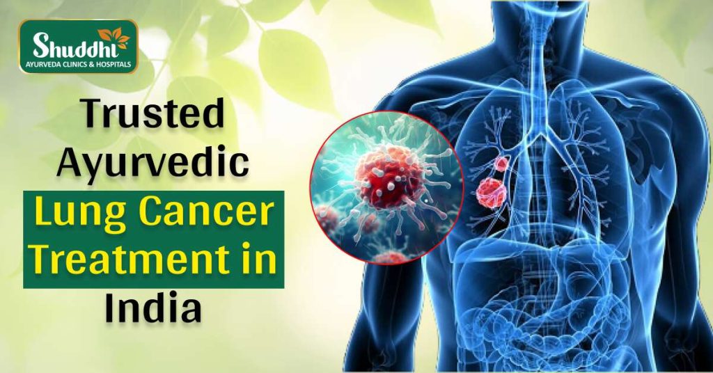 Ayurvedic Lung Cancer Treatment in India
