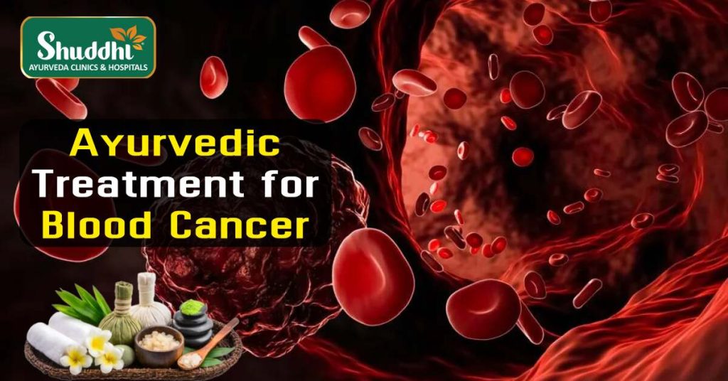 Ayurvedic Treatment for Blood Cancer