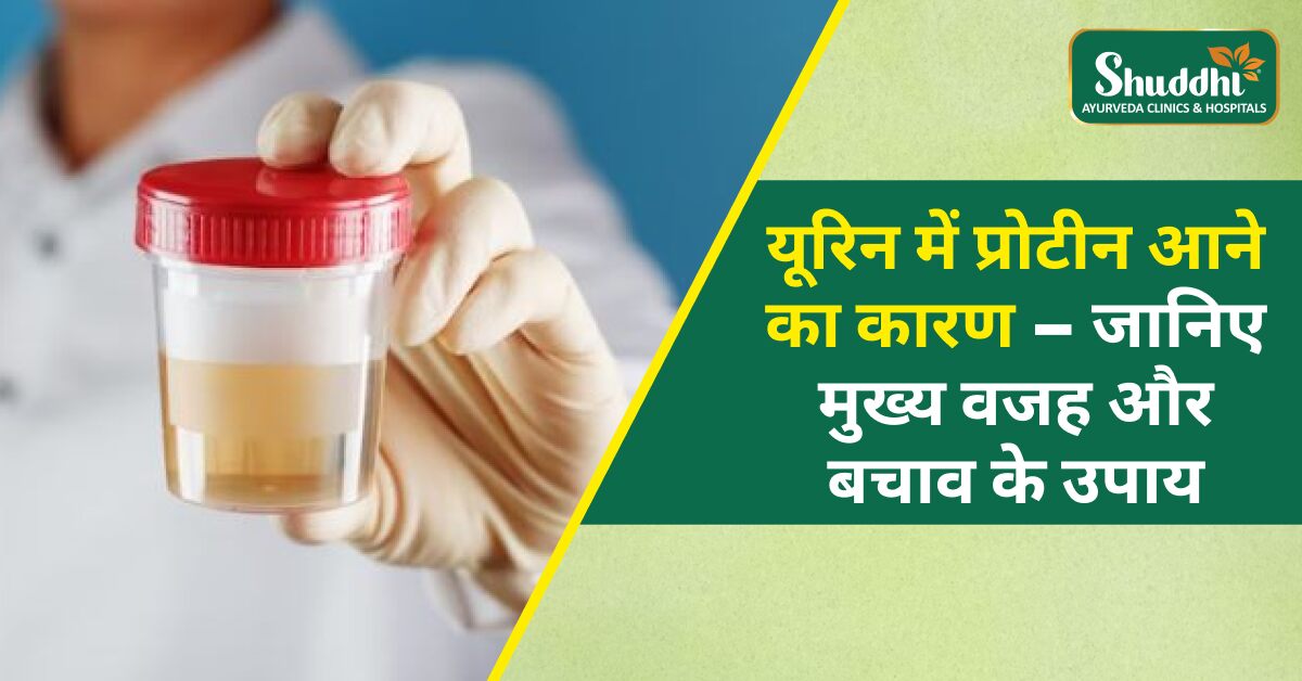 यूरिन में प्रोटीन आने का कारण