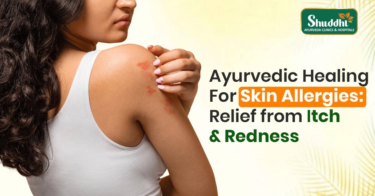 Ayurvedic Treatment for Itchy Skin