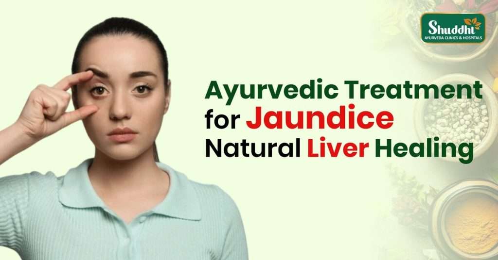 Ayurvedic Treatment for Jaundice